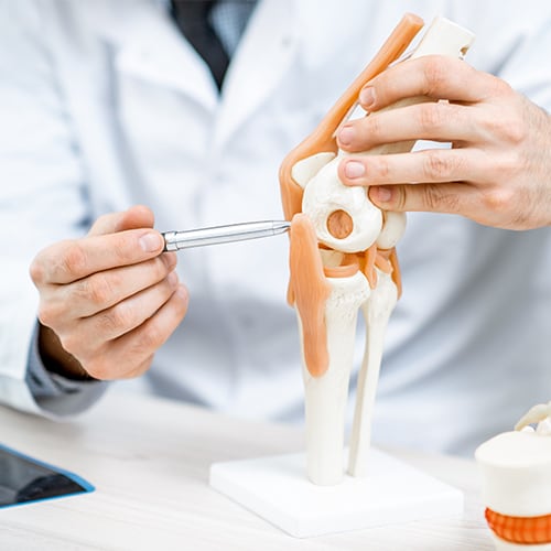 arthrose et prothese du genoux docteur antonin leroy chirurgien orthopediste paris longjumeau specialiste epaule genou pied